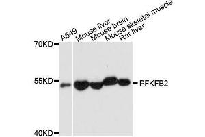 PFKFB2 Antikörper  (AA 446-505)