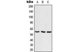 Western blot analysis of SFRS11 expression in NCI-H292 (A), SP2/0 (B), H9C2 (C) whole cell lysates. (SRSF11 antibody  (Center))