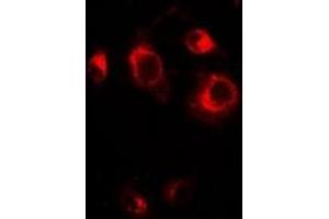 Immunofluorescent analysis of GRASP65 staining in A549 cells. (GORASP1 antibody)