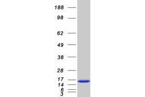 Validation with Western Blot (CSTB Protein (Myc-DYKDDDDK Tag))