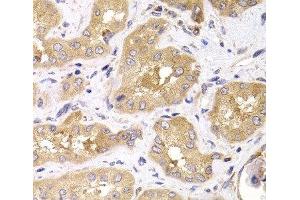 Immunohistochemistry of paraffin-embedded Human kidney using RPS4X Polyclonal Antibody at dilution of 1:100 (40x lens). (RPS4X antibody)