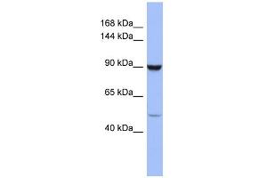 WB Suggested Anti-ZFP28 Antibody Titration:  0. (ZFP28 antibody  (Middle Region))