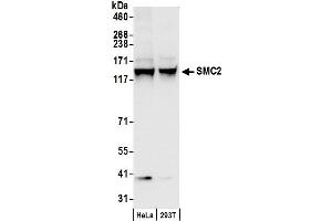 Western Blotting (WB) image for anti-Structural Maintenance of Chromosomes 2 (SMC2) (C-Term) antibody (ABIN7453335)