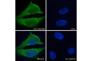 ABIN185659 Immunofluorescence analysis of paraformaldehyde fixed HeLa cells, permeabilized with 0. (Hsc70 antibody  (Internal Region))