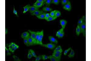 Immunofluorescence staining of HepG2 cells with ABIN7157520 at 1:100, counter-stained with DAPI. (KIR2DS5 antibody  (AA 162-242))