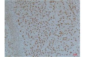 Immunohistochemistry (IHC) analysis of paraffin-embedded Mouse Brain Tissue using Kv11.