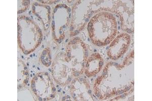 Used in DAB staining on fromalin fixed paraffin- embedded kidney tissue (TRAPPC10 antibody  (AA 74-357))