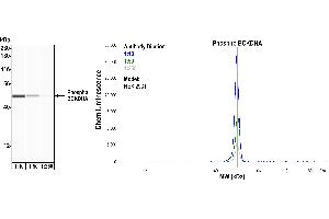 Western Blotting (WB) image for anti-Branched Chain Keto Acid Dehydrogenase E1, alpha Polypeptide (BCKDHA) (pSer292) antibody (ABIN7449282)