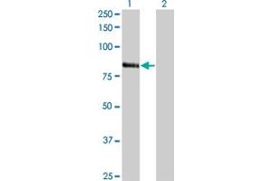 Western Blot analysis of RNF103 expression in transfected 293T cell line by RNF103 monoclonal antibody (M01), clone 3E7. (RNF103 antibody  (AA 501-599))
