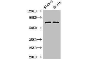 Western Blot Positive WB detected in: Mouse kidney tissue, Mouse brain tissue All lanes: GAA Antibody at 3 μg/mL Secondary Goat polyclonal to rabbit IgG at 1/50000 dilution Predicted band size: 70, 76, 106 kDa Observed band size: 70 kDa