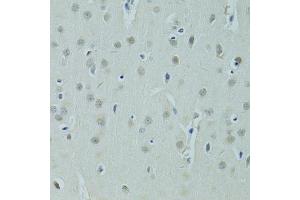 Immunohistochemistry of paraffin-embedded rat brain using ZNF346 antibody (ABIN5975303) at dilution of 1/100 (40x lens). (ZNF346 antibody)