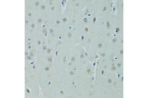 Immunohistochemistry of paraffin-embedded rat brain using ZNF346 antibody (ABIN5975303) at dilution of 1/100 (40x lens). (ZNF346 antibody)