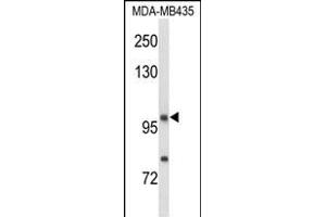 Western blot analysis of NRP1 Antibody (C-term) (ABIN653013 and ABIN2842638) in MDA-M cell line lysates (35 μg/lane). (Neuropilin 1 antibody  (C-Term))