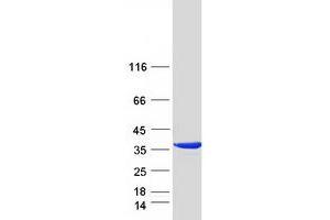 Validation with Western Blot