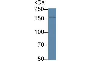 Detection of APOB in Human HepG2 cell lysate using Polyclonal Antibody to Apolipoprotein B (APOB) (APOB antibody  (AA 2747-2913))