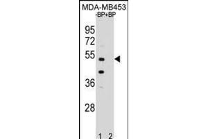 Western blot analysis of WDR51B Antibody (C-term) Pab (ABIN654969 and ABIN2844607) pre-incubated without(lane 1) and with(lane 2) blocking peptide in MDA-M cell line lysate.