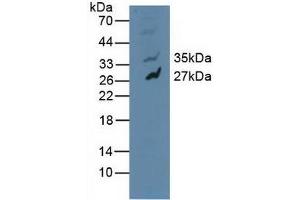 Detection of MAPK10 in Human U-87MG Cells using Polyclonal Antibody to Mitogen Activated Protein Kinase 10 (MAPK10) (MAPK10 antibody  (AA 88-332))