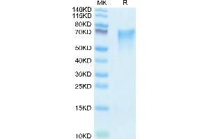 Human LYPD3 on Tris-Bis PAGE under reduced condition. (LYPD3 Protein (AA 31-286) (His tag))