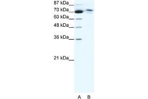 WB Suggested Anti-C14ORF101 Antibody Titration:  0. (C14orf101 antibody  (N-Term))