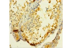 Immunohistochemistry of paraffin-embedded human testis tissue using ABIN7175117 at dilution of 1:100 (UCK1 antibody  (AA 1-201))