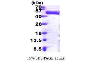 SDS-PAGE (SDS) image for Mitogen-Activated Protein Kinase 3 (MAPK3) (AA 1-379) protein (His tag) (ABIN667192)