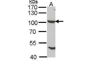 WB Image Sample (30 ug of whole cell lysate) A: cos 7 7. (NUP98 antibody)