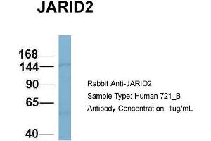 Host: Rabbit Target Name: JARID2 Sample Type: 721_B Antibody Dilution: 1. (JARID2 antibody  (N-Term))