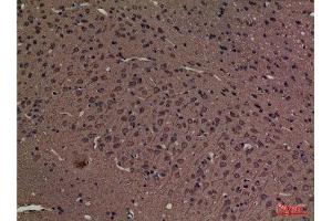 Immunohistochemistry (IHC) analysis of paraffin-embedded Rat Brain, antibody was diluted at 1:100. (SPTLC1 antibody  (C-Term))