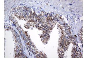 Image no. 6 for anti-NADH Dehydrogenase (Ubiquinone) 1 beta Subcomplex, 10, 22kDa (NDUFB10) antibody (ABIN1499672) (NDUFB10 antibody)