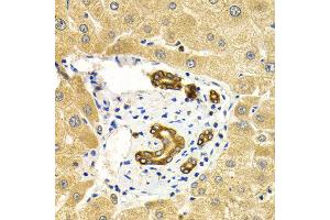 Immunohistochemistry of paraffin-embedded human liver injury using RAB27A antibody at dilution of 1:200 (400x lens). (RAB27A antibody)