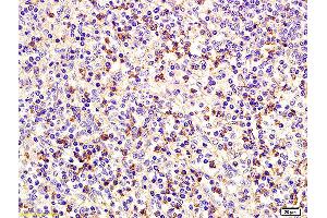Formalin-fixed and paraffin embedded human spleen labeled with Anti CD75 Polyclonal Antibody, Unconjugated (ABIN704201) at 1:200 followed by conjugation to the secondary antibody and DAB staining.