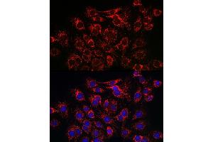 Immunohistochemistry of paraffin-embedded rat heart using SERC/ Rabbit pAb (ABIN3021429, ABIN3021430, ABIN3021431 and ABIN6215028) at dilution of 1:150 (40x lens). (ATP2A2 antibody  (AA 111-253))