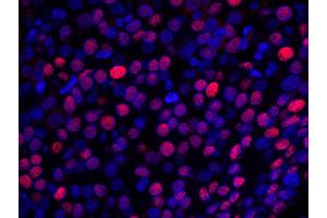 Immunofluorescence (IF) image for anti-Nuclear Casein Kinase and Cyclin-Dependent Kinase Substrate 1 (NUCKS1) (AA 1-50) antibody (ABIN7448993)