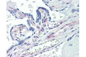 Anti-PDGFRB antibody IHC of human placenta. (PDGFRB antibody)