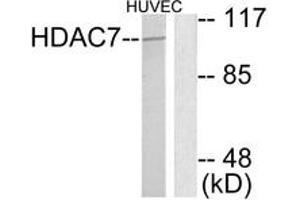 Western blot analysis of extracts from HuvEc cells, using HDAC7 Antibody.