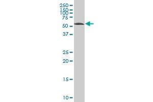 CPNE4 polyclonal antibody (A01), Lot # 060614JCS1 Western Blot analysis of CPNE4 expression in HeLa .