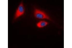 Immunofluorescent analysis of SHPTP1 (pY536) staining in HeLa cells. (SHPTP1 (C-Term), (pTyr536) antibody)