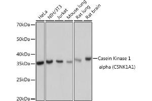 Western blot analysis of extracts of various cell lines, using Casein Kinase 1 alpha (Casein Kinase 1 alpha (CSNK1)) Rabbit mAb (ABIN7266098) at 1:1000 dilution. (CSNK1A1 antibody)