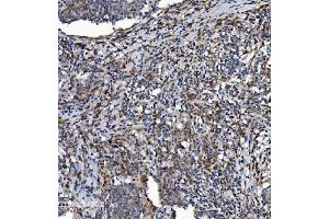 IHC analysis of NDUFB2 using anti-NDUFB2 antibody (ABIN7600162).