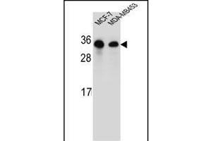 SAR1B Antibody (Center) (ABIN654355 and ABIN2844120) western blot analysis in MCF-7,MDA-M cell line lysates (35 μg/lane). (SAR1B antibody  (AA 89-116))