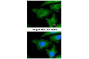 ICC/IF Image Immunofluorescence analysis of paraformaldehyde-fixed HeLa, using UBE2L3, antibody at 1:200 dilution. (UBE2L3 antibody  (C-Term))