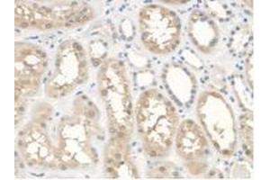 IHC-P analysis of Human Kidney Tissue, with DAB staining. (ANTXR2 antibody  (AA 34-318))