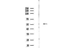 Western blot analysis of lysates from COLO205 cells(heat-shock,45 min treatment), using SLC1 Antibody at 1/1000 dilution.