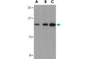Western blot analysis of BAD in T24 cell lysates with BAD polyclonal antibody  at (A) 0. (BAD antibody  (C-Term))