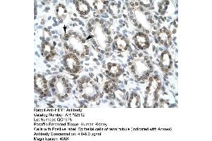 Immunohistochemistry (IHC) image for anti-Ha-Ry/enhancer-of-Split Related with YRPW Motif 1 (HEY1) (C-Term) antibody (ABIN2779686)