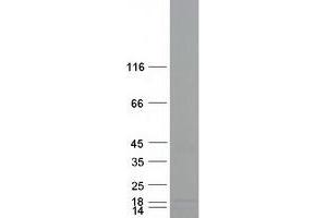 Western Blotting (WB) image for Ribonuclease, RNase A Family, 4 (RNASE4) (Transcript Variant 3) protein (Myc-DYKDDDDK Tag) (ABIN2730991)