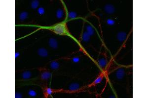 Indirect immmunostaining of PFA fixed rat hippocampus neurons with anti-GAP 43 (dilution: 1 : 500; red) and mouse anti-MAP 2 (cat. (GAP43 antibody)