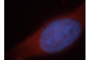 Immunofluorescence (IF) image for anti-Hepatic and Glial Cell Adhesion Molecule (HEPACAM) antibody (ABIN2932707) (HEPACAM antibody)