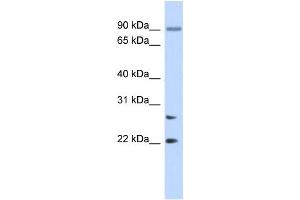 Western Blotting (WB) image for anti-Josephin Domain Containing 2 (JOSD2) antibody (ABIN2459544) (JOSD2 antibody)