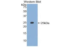 Western Blotting (WB) image for anti-Structural Maintenance of Chromosomes 3 (SMC3) (AA 994-1181) antibody (ABIN1860595) (SMC3 antibody  (AA 994-1181))